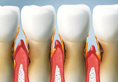 Periodontology