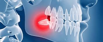 Maxillofacial surgery