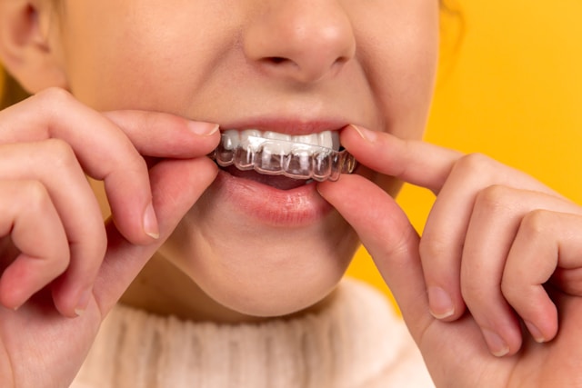 Mouth guards
